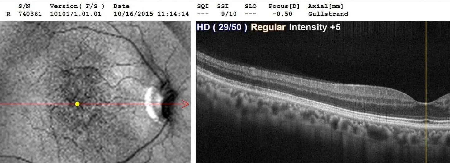 5 Amazing New Eye Exam Technologies That You Should Ask Your Doctor About