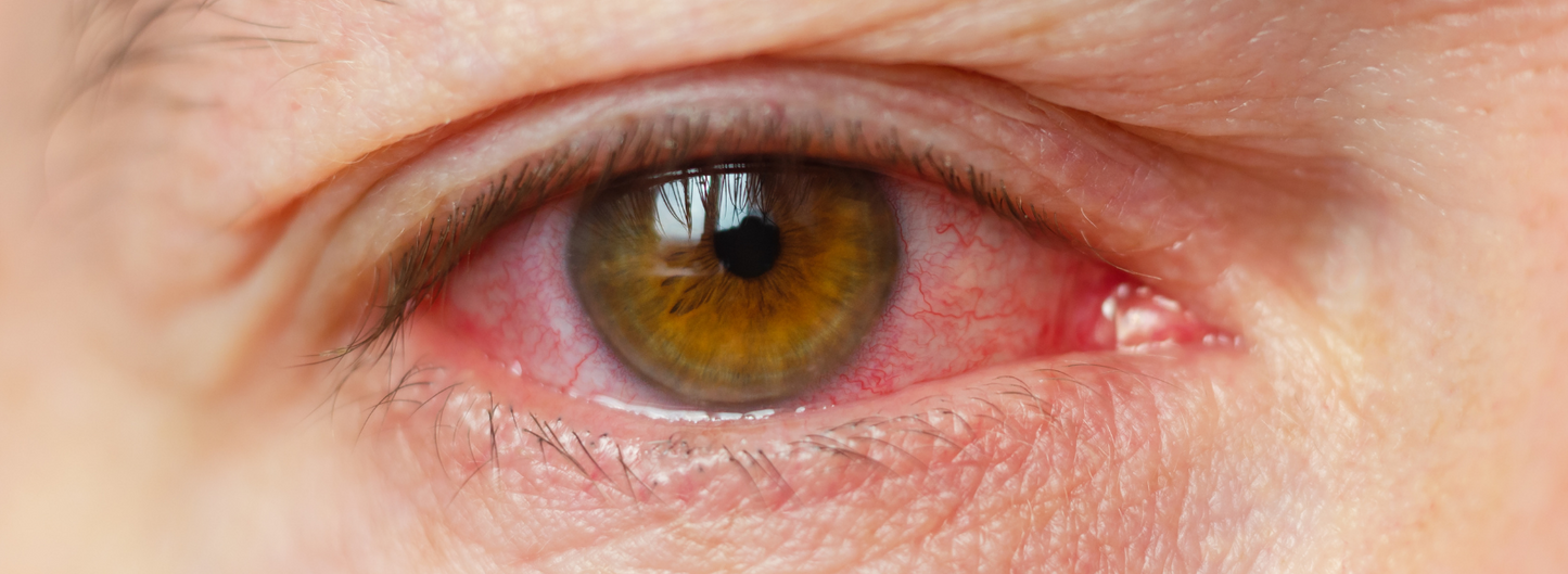 Preservative Free Eye Drops – Can They Help You?